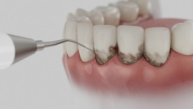 Reliable Dental Implants contractor in Eagle, NE by Smile Center Dentistry